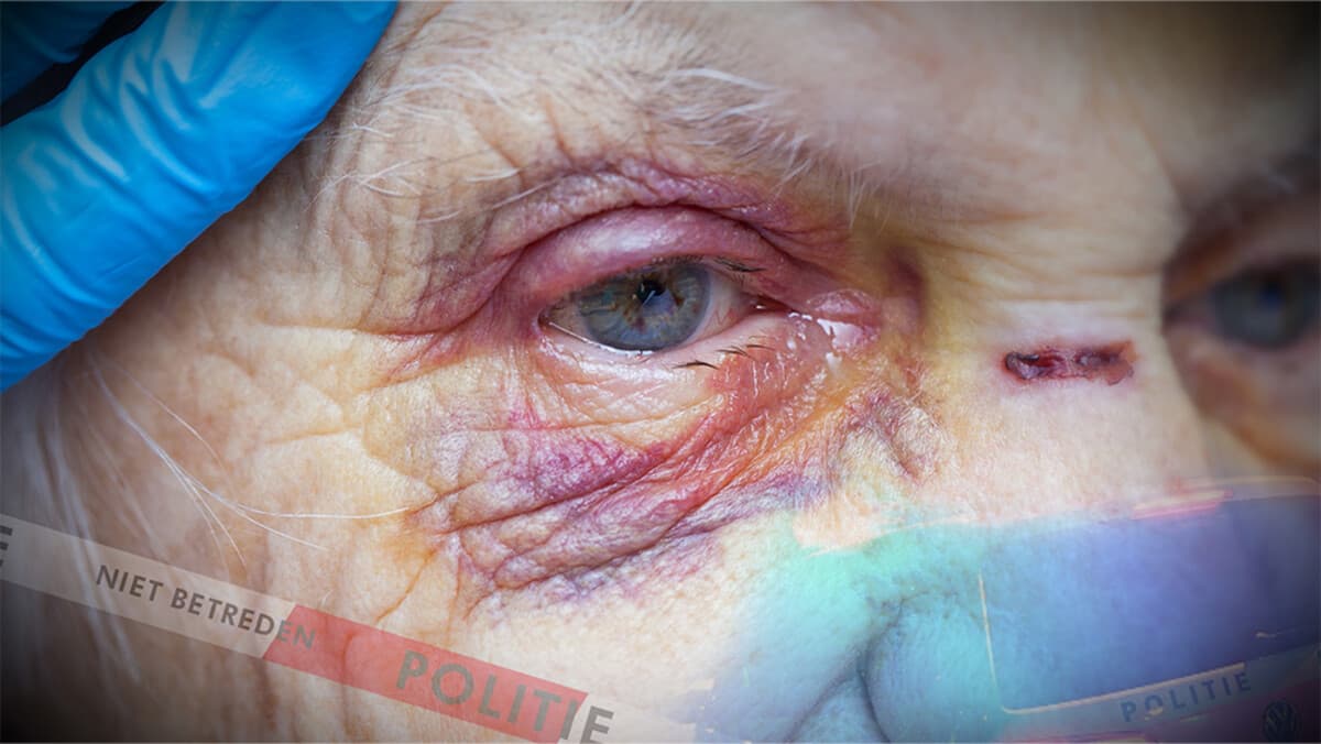 Ouderenmishandeling veel te weinig gemeld